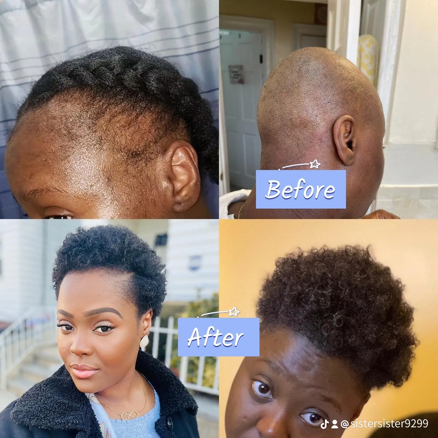 Rapid Hair Growth Oil (Bundle 2)